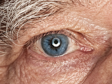 Уход за пожилыми людьми с глаукомой | на сайте «Лотос»